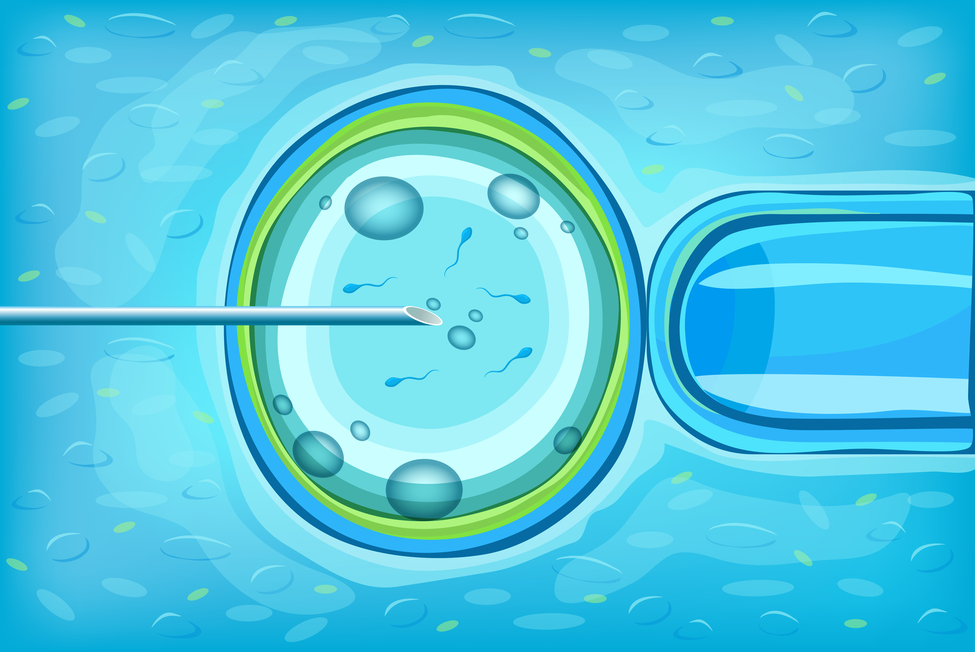 Egg Freezing Process in India Step By Step: Costs & Success Rates