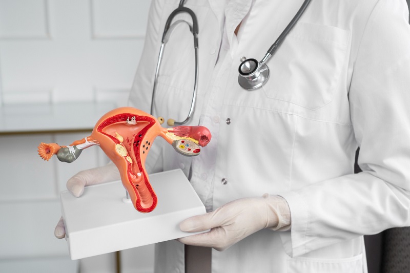 What is Endometriosis? Causes, Symptoms, Diagnosis &Treatments